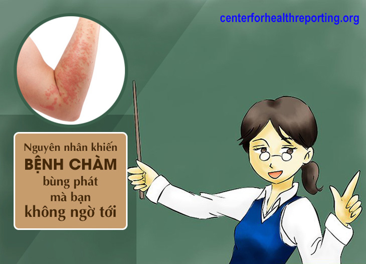 Bệnh chàm có thể do nhiều nguyên nhân mà khởi phát