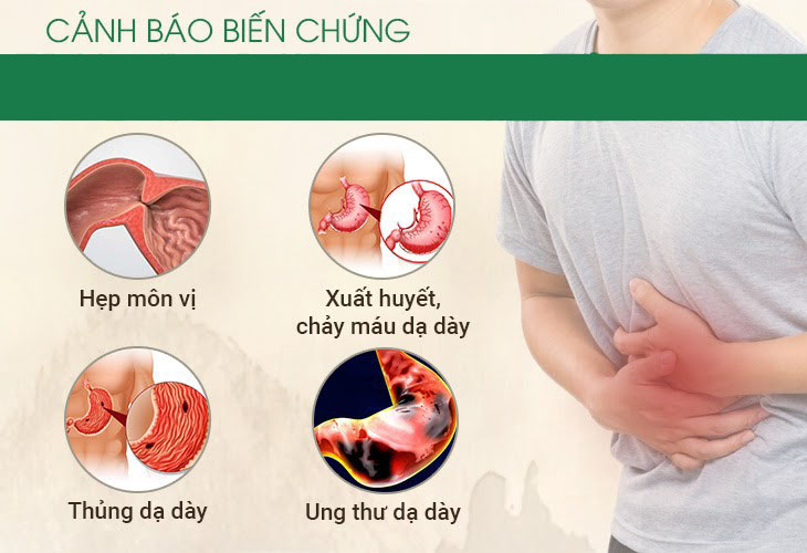 Mức độ các biến chứng bệnh đau dạ dày ngày càng tăng nếu không được điều trị đúng và kịp thời