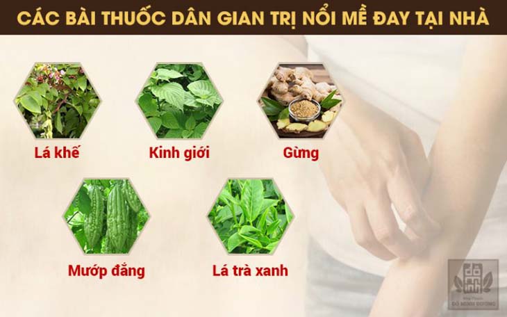 Chữa nổi mề đay tại nhà