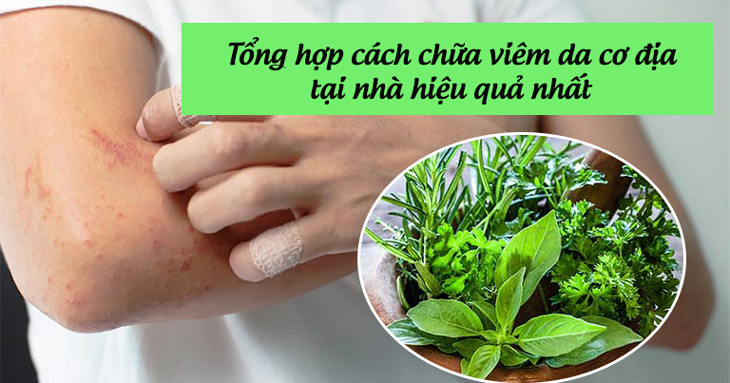 Nhiều người chọn cách chữa viêm da cơ địa tại nhà vì an toàn, hiệu quả