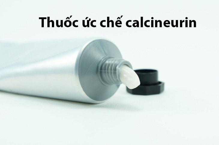 Các thuốc ức chế calcineurin giúp cải thiện tốt tình trạng của bệnh