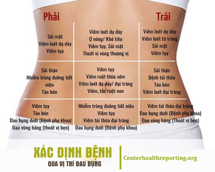 Hình ảnh mô tả các vị trí đau của một số bệnh lý vùng bụng