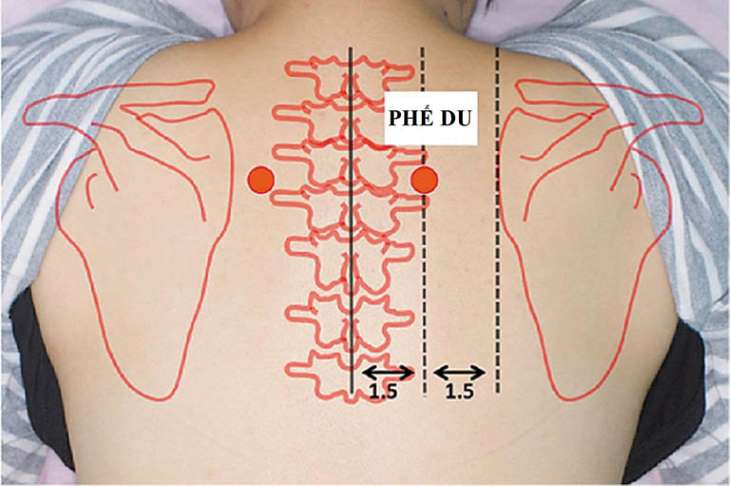 Bấm huyệt phế du giúp giảm ho hiệu quả