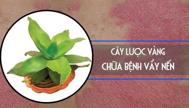 Chữa vảy nến bằng cây lược vàng đem lại hiệu quả rõ rệt cho người bệnh