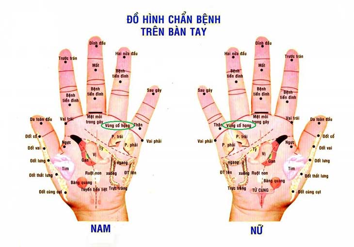 Điều trị hiệu quả chứng đau rát cổ họng nhờ diện chẩn