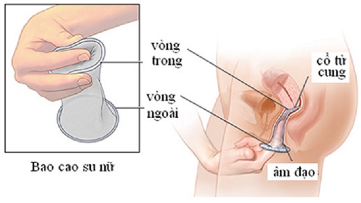 Chảy máu có thể do móng tay cọ xát vào thành âm đạo khi chị em không dùng bao cao su bao bọc