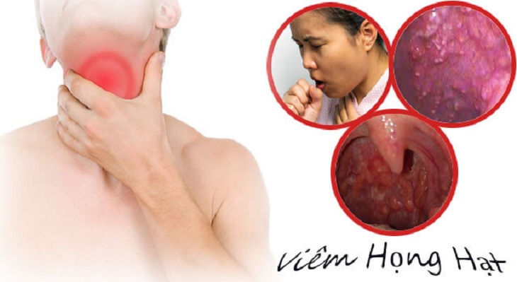 Đốt viêm họng hạt giúp người bệnh dễ chịu khi ăn uống nuốt nước bọt