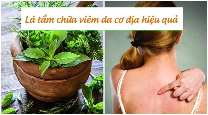 Tìm hiểu những loại lá tắm chữa viêm da cơ địa hiệu quả nhất