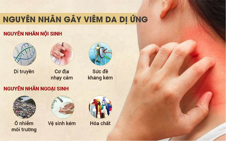 Nguyên nhân gây viêm da dị ứng