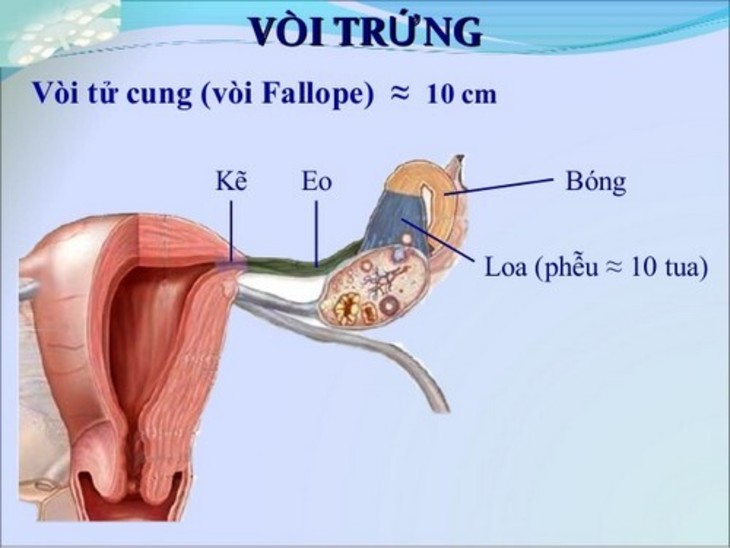 Vị trí đoạn bóng của vòi trứng