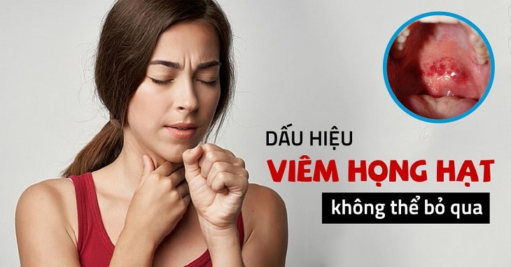 Sớm nhận biết triệu chứng viêm họng hạt giúp ngừa biến chứng