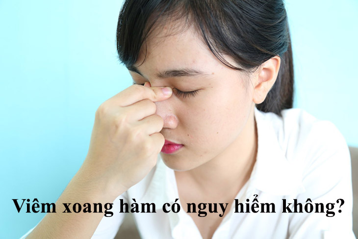 Viêm xoang hàm có nguy hiểm không khi đây là bệnh lý phổ biến tại đường hô hấp