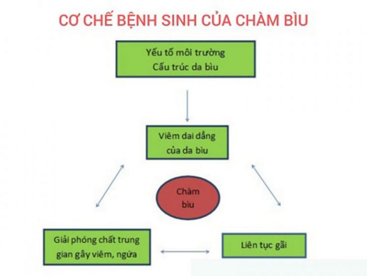 Muốn biết chàm bìu có lây không hãy xem cơ chế sinh bệnh của chàm bìu