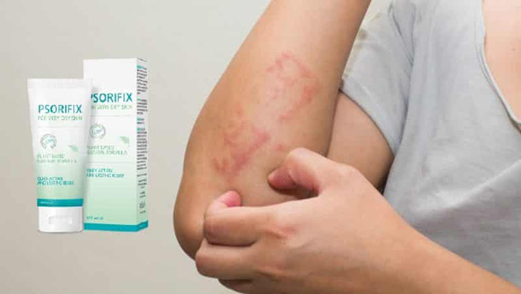 Kem Psorifix phù hợp với mọi đối tượng bệnh nhân và loại hình vảy nến khác nhau