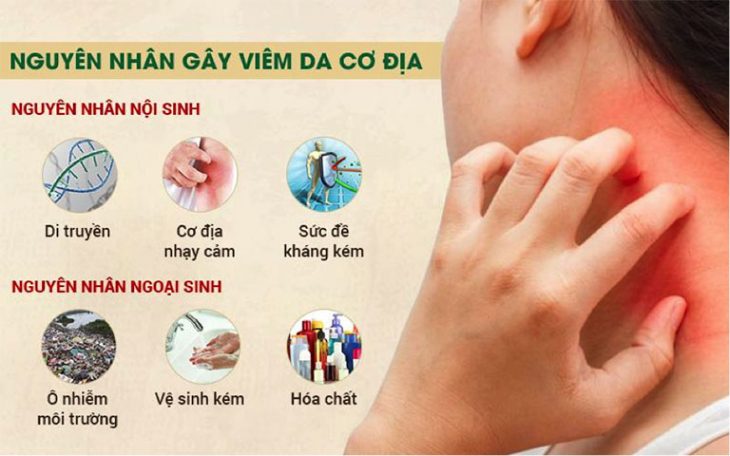 Có nhiều nguyên nhân làm tăng nguy cơ mắc bệnh viêm da cơ địa