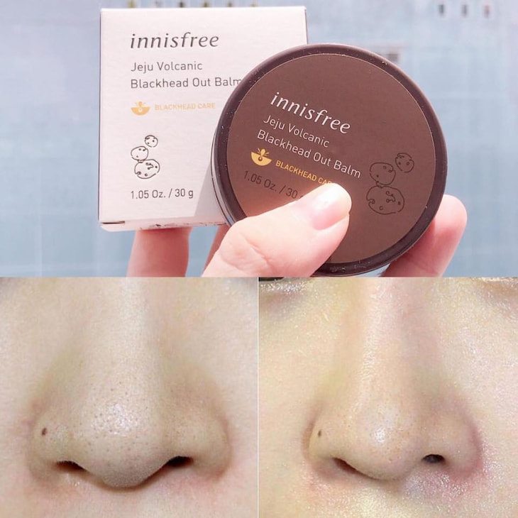 Sáp trị mụn đầu đen Innisfree được nhiều chị em tin dùng