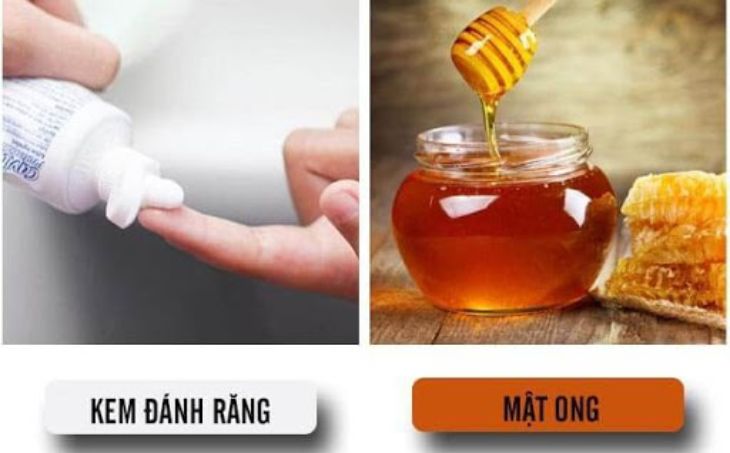 Sử dụng kem đánh răng và mật ong để trị tàn nhang trên da