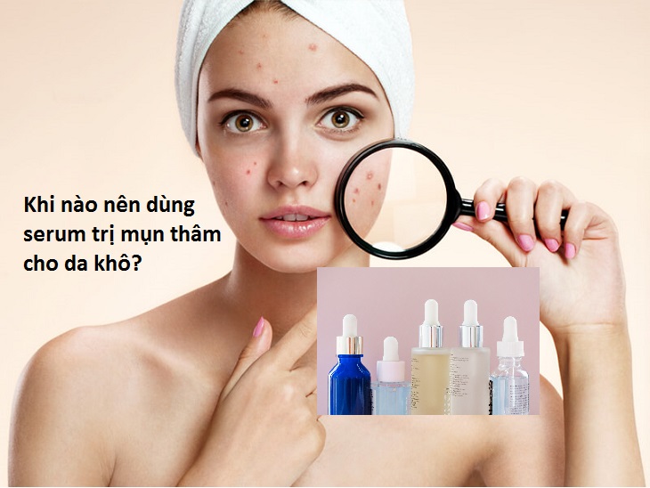 Khi nào nên dùng serum trị mụn thâm cho da khô?