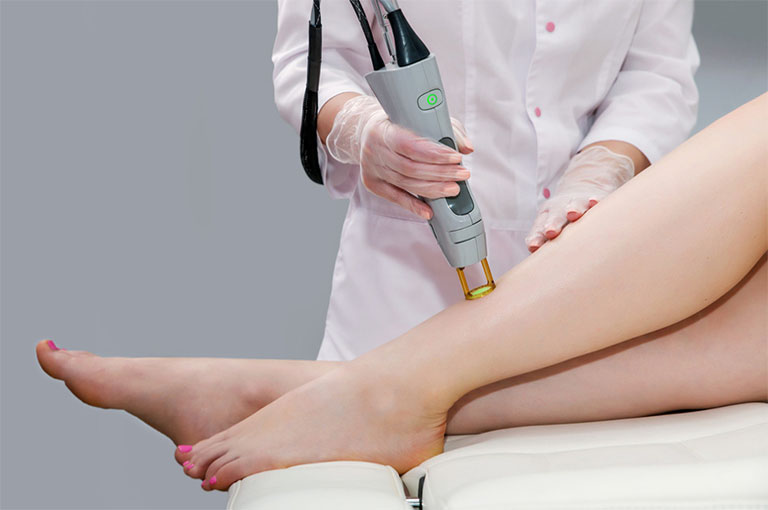 Phương pháp trị viêm nang lông bằng laser