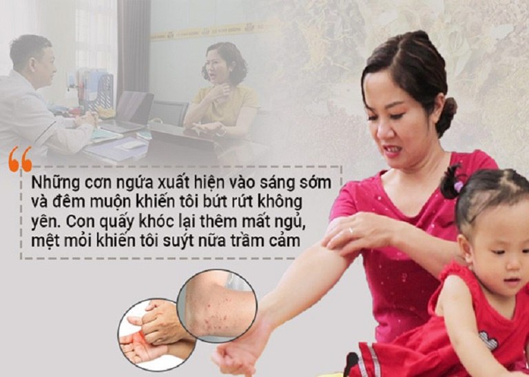 Diễn viên Nguyệt Hằng khổ sở vì mề đay sau sinh