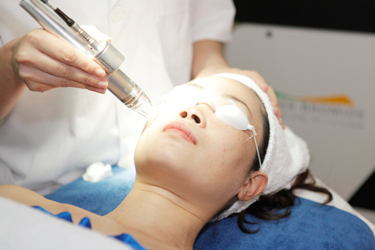 Trị mụn trứng cá ung bằng công nghệ laser