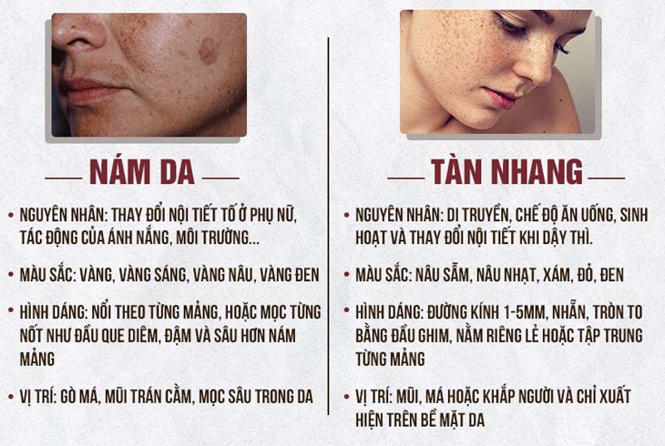 Nguyên nhân gây nám, tàn nhang phổ biến