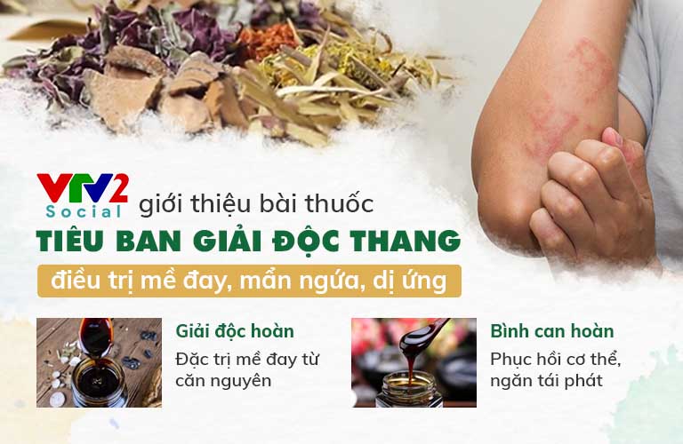 Công thức thuốc Tiêu ban Giải độc thang được giới thiệu trên VTV2