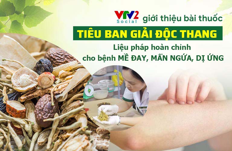 VTV2 giới thiệu bài thuốc Tiêu ban Giải độc thang