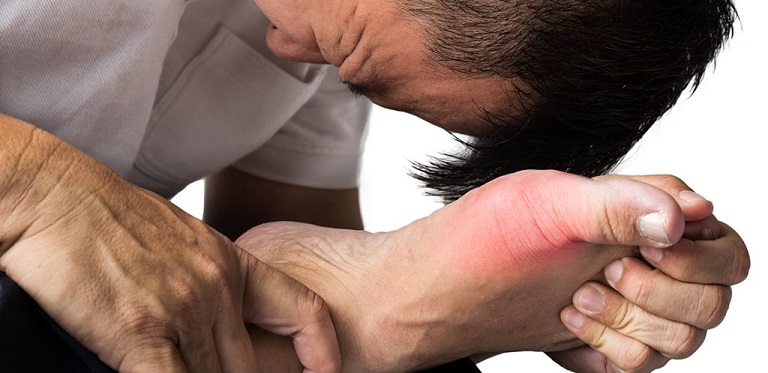 Gout gây đau đớn dữ dội về đêm