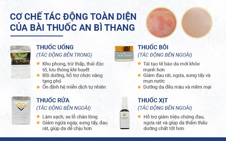 Các chế phẩm trong bài thuốc An Bì Thang được ứng dụng điều trị viêm da tiếp xúc