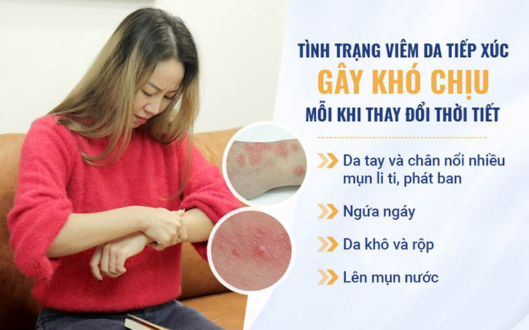 Các dấu hiệu điển hình của bệnh viêm da tiếp xúc