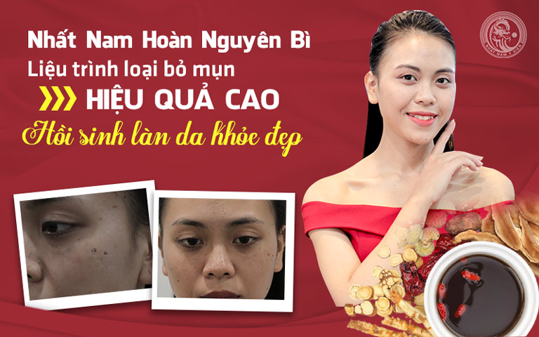 Làn da trước và sau khi dùng Nhất Nam Hoàn Nguyên Bì của chị Trang