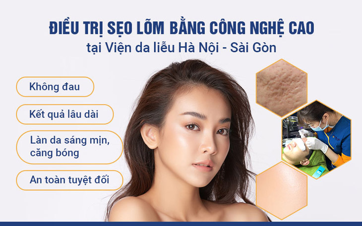 Bóc tách đáy sẹo tại Viện Da liễu Hà Nội - Sài Gòn đem lại hiệu quả toàn diện, ngừa tái phát