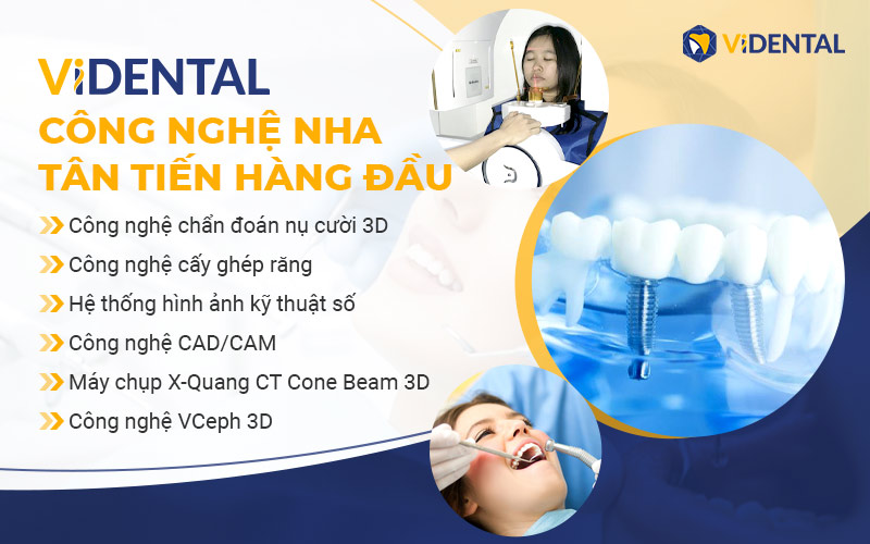 Vidental đầu tư nhiêu vào công nghệ, cơ sở vật chất