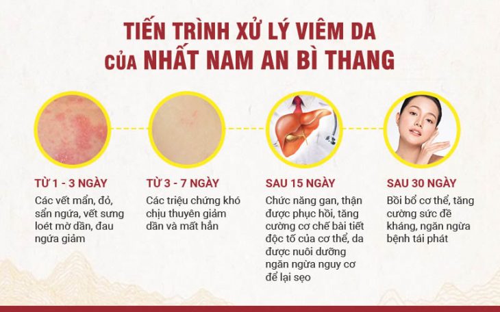 Phác đồ điều trị viêm da dầu