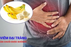 viêm đại tràng ăn chuối được không